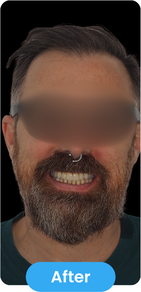 After Image